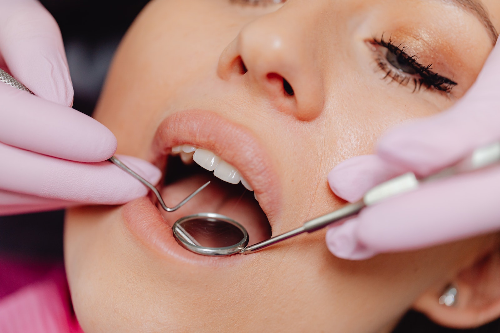 General Dental Checkups | Emergency Dental Treatment