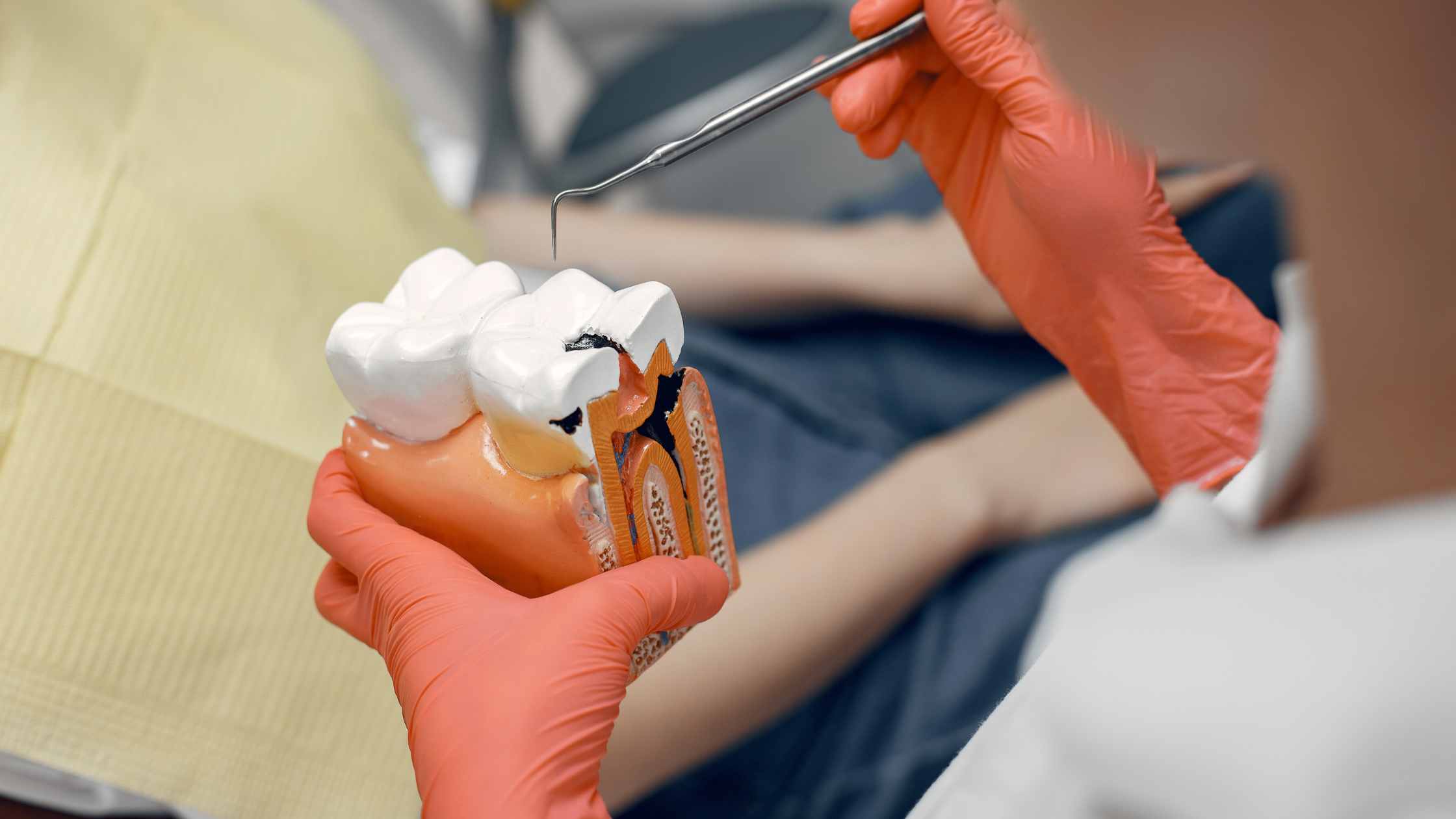 Root Canal Treatment in Cleveland